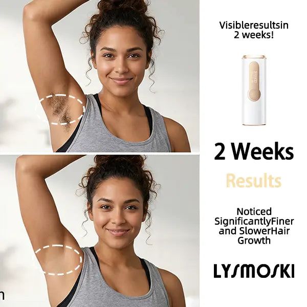 Hair Removal Device - 3-in-1, 999900 Flashes