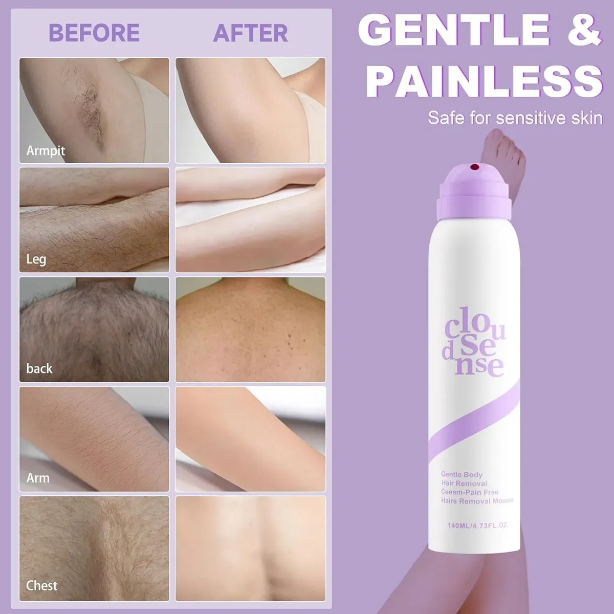 Hair Removal Mousse
