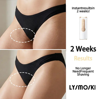 Hair Removal Device - 3-in-1, 999900 Flashes